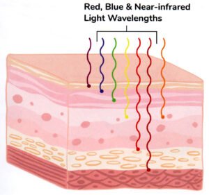 Red Light Therapy